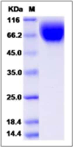 Sino Biological Recombinant Rat SIRP alpha/SHPS-1 Protein (His Tag), HPLC-verified,