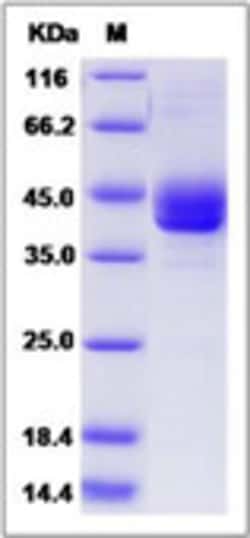 Sino Biological Recombinant Rat CD59 Protein (hFc Tag), Quantity: Each
