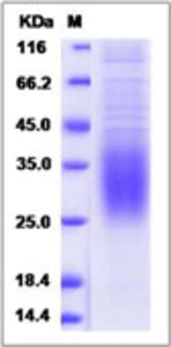 Sino Biological Rat CD47 Protein (His Tag) 100ug, Quantity: Each of 1