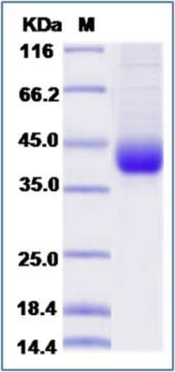 Sino Biological Recombinant Rat IL-2R beta/CD122 Protein (His Tag), Quantity: