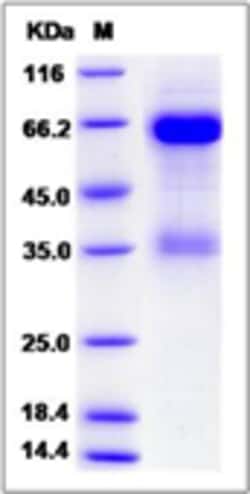Sino Biological Recombinant Rat NKp46/NCR1 Protein (hFc Tag), Quantity: