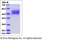 Sino Biological Recombinant Rat PD-L1/B7-H1 Protein (ECD, His Tag), HPLC-verified,