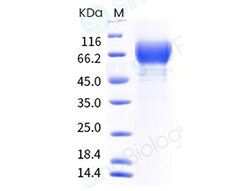 Sino Biological Recombinant Rat GUCY2C/Guanylyl cyclase C Protein (ECD,
