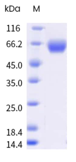 Sino Biological&nbsp;Recombinant Rat IL1RAP/IL-1RAcP Protein (His Tag), HPLC-verified 100 µg
