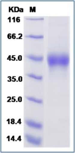Sino Biological Recombinant Rat TROP-2 Protein (His Tag), HPLC-verified,