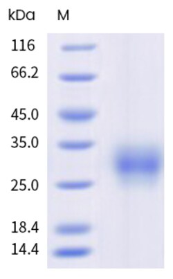 Sino Biological&nbsp;Recombinant Rat IL-31 Protein (His Tag), HPLC-verified 1