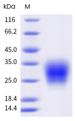 Sino Biological&nbsp;Recombinant Rat IL-31 Protein (His Tag), HPLC-verified 1
