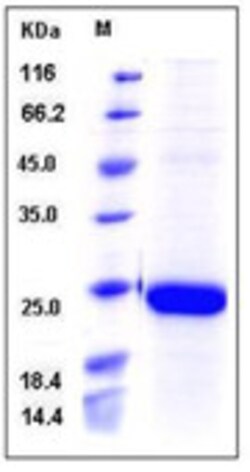 Sino Biological Rhesus IL-18 / IL-1F4 Protein (His Tag) 50ug, Quantity: