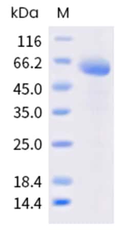 Sino Biological Cynomolgus FCGR2A Protein 1MG (Sino Biological), Quantity: