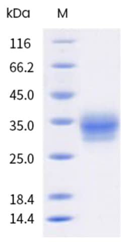 Sino Biological Rhesus FCGR2A Protein 100ug (Sino Biological), Quantity: