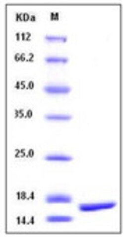 Sino Biological Recombinant Cynomolgus, Rhesus TNF-alpha Protein, Quantity: