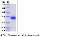 Sino Biological Cynomolgus / Rhesus Angiopoietin-2 / ANG2 Protein (His