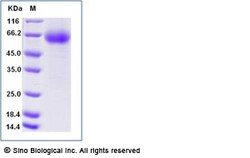 Sino Biological Cynomolgus / Rhesus Angiopoietin-2 / ANG2 Protein (His