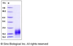 Sino Biological Recombinant Cynomolgus Lymphotactin/XCL1/SCYC1 Protein