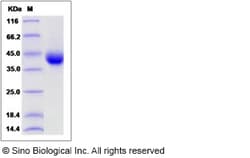 Sino Biological Recombinant Cynomolgus, Rhesus TNFR-2 / CD120b Protein
