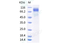 Sino Biological Recombinant Rhesus IL-2R gamma/CD132 Protein (ECD, hFc