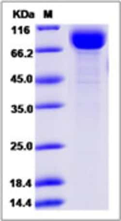 Sino Biological Recombinant Cynomolgus IL-18Rα Protein (hFc Tag), Quantity: