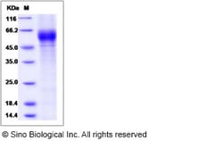 Sino Biological Recombinant Rhesus IL-18R beta / IL-18RAP Protein (His