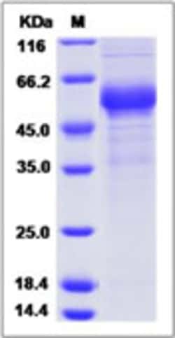 Sino Biological Recombinant Cynomolgus COLEC10 Protein (hFc Tag), Quantity: