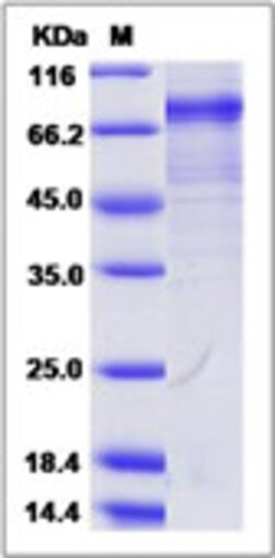 Sino Biological Recombinant Rhesus CDH18 Protein (His Tag), Quantity: Each
