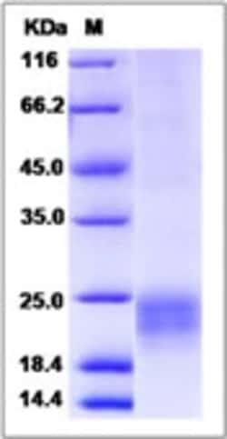 Sino Biological Recombinant Rhesus NKG2D Protein (aa 78-216, His Tag),