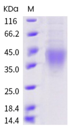 Sino Biological Human / Cynomolgus / Rhesus CD28 Protein (ECD, His Tag)