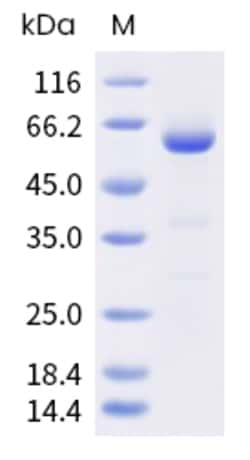 Sino Biological Cynomolgus CD73 / NT5E Protein (His Tag) 500ug, Quantity: