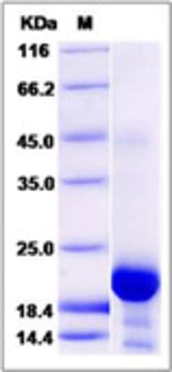 Sino Biological Recombinant Cynomolgus, Rhesus IL-6 Protein, Quantity: