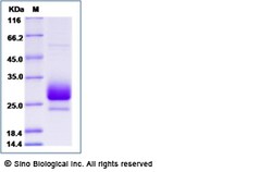 Sino Biological Recombinant Cynomolgus, Rhesus CD79B Protein (ECD, His
