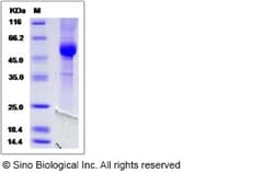 Sino Biological Cynomolgus / Rhesus NKG2A Protein (Fc Tag) 1mg, Quantity:
