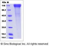 Sino Biological Rhesus Siglec-2 / CD22 Protein (His Tag) 1mg, Quantity: