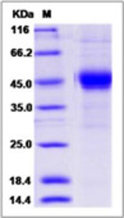 Sino Biological Recombinant Rhesus BTLA Protein (hFc Tag), Quantity: Each