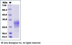 Sino Biological Recombinant Rhesus BTLA Protein (His Tag), HPLC-verified,