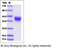 Sino Biological Recombinant Cynomolgus CD25/IL-2R alpha Protein, HPLC-verified,