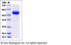 Sino Biological Recombinant Rhesus CD4 Protein (His Tag), HPLC-verified,