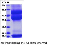 Sino Biological Recombinant Cynomolgus TGF beta 1 Protein (Latent, His