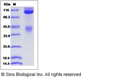 Sino Biological Recombinant Cynomolgus, Rhesus c-MET/HGFR Protein (hFc