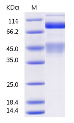 Sino Biological Cynomolgus, Rhesus MET Protein 20ug (Sino Biological),