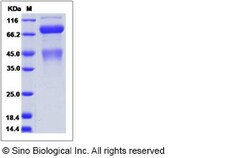 Sino Biological Cynomolgus / Rhesus c-MET / HGFR Protein (His Tag) 1mg,