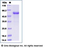 Sino Biological Recombinant Human Cystatin SA Protein (His Tag), Quantity: