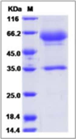 Sino Biological Recombinant Cynomolgus TIM-3/HAVCR2 Protein (hFc Tag) 1,