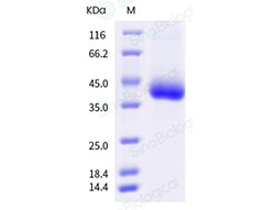 Sino Biological Recombinant Rhesus IL-2R beta/CD122 Protein (His Tag),