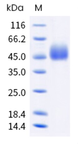 Sino Biological Cynomolgus NCR3LG1 Protein 100ug (Sino Biological), Quantity: