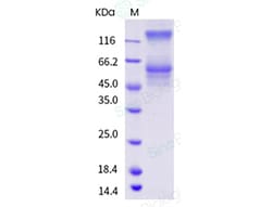 Sino Biological Recombinant Cynomolgus LAG-3 Protein (74 Pro, His Tag),