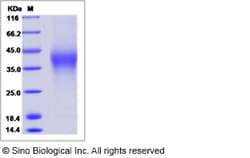 Sino Biological Recombinant Cynomolgus VISTA/B7-H5 Protein (His Tag) 500,