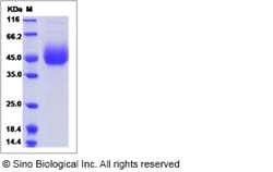 Sino Biological Recombinant Rhesus OX40/TNFRSF4 Protein (His Tag), HPLC-verified,