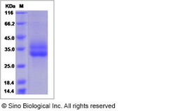 Sino Biological Recombinant Cynomolgus, Rhesus 4-1BB/CD137 Protein (His
