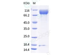 Sino Biological Recombinant Cynomolgus IL-13 R alpha 1/IL13RA1 Protein