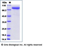 Sino Biological Recombinant Cynomolgus FAP Protein (ECD, His Tag), Quantity: