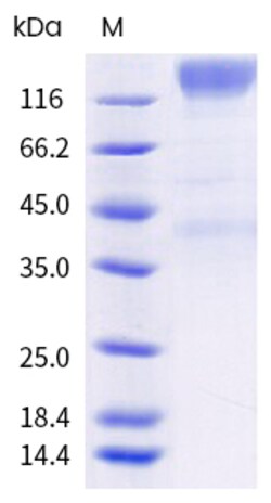 Sino Biological Cynomolgus CEACAM5 Protein (Fc Tag) 1mg, Quantity: Each